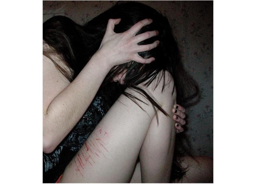 Sebapoškodzovanie Sebapoškodzovanie